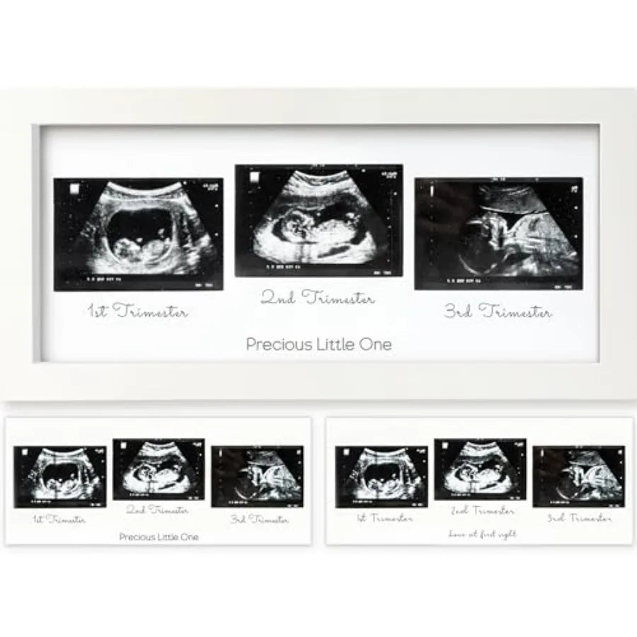 Baby Picture Frames - Ultrasound Picture Frames, First Time Mom Gift, Cute Pregnancy Reveal Photo Frame, Baby Gender Reveal Gif