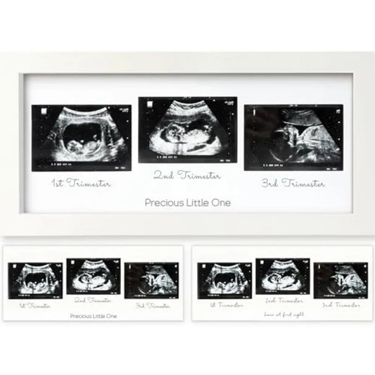 Baby Picture Frames - Ultrasound Picture Frames, First Time Mom Gift, Cute Pregnancy Reveal Photo Frame, Baby Gender Reveal Gif